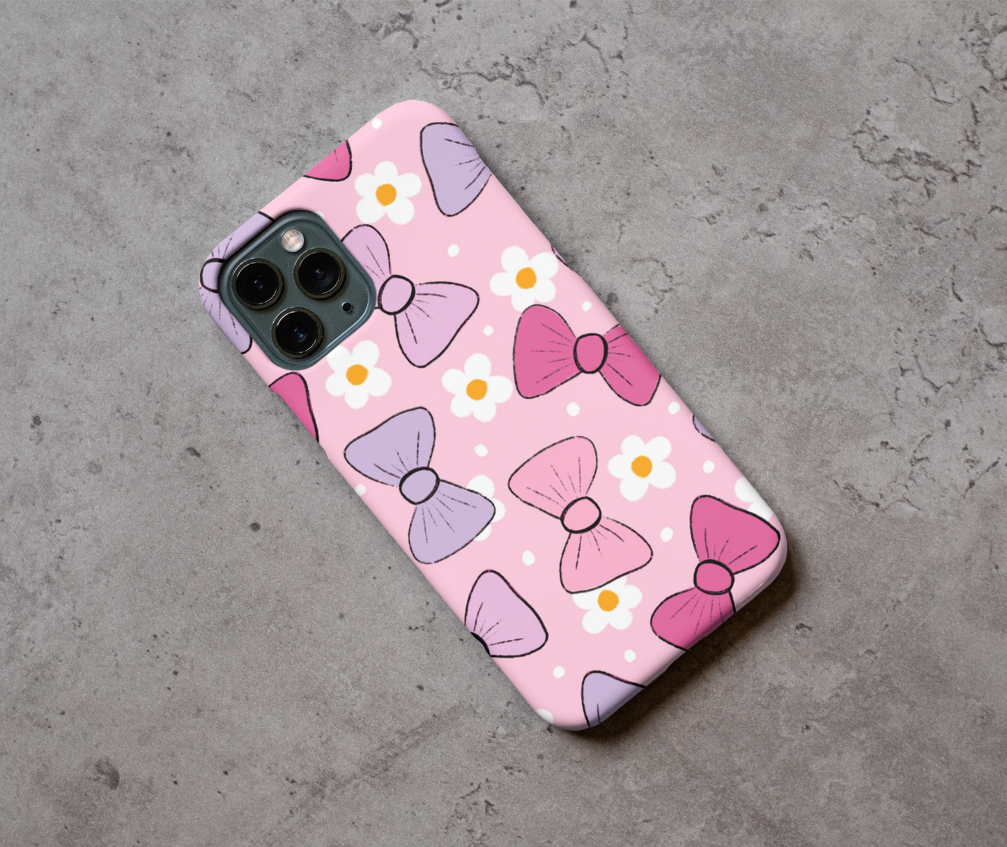 Cute bows phone case